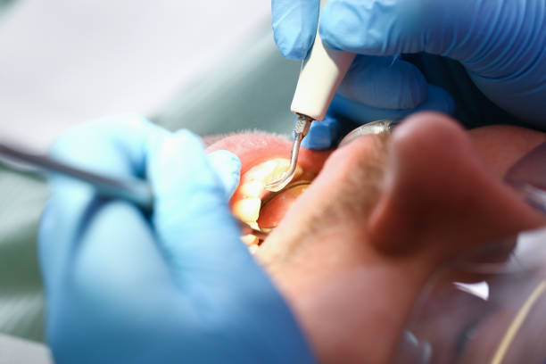 Best Broken or Cracked Tooth Emergency Dentist in Northlake, TX